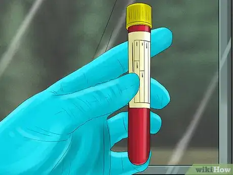 Image titled Take Blood Samples from Cattle Step 9