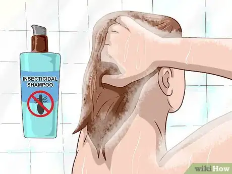 Image titled Stop Scalp Picking Step 14