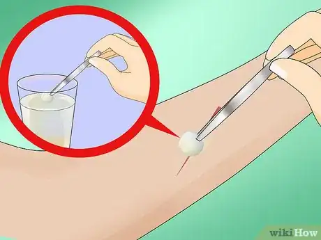 Image titled Make a Quick Disinfectant for Minor Cuts and Abrasions Step 6