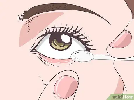 Image titled Get Stuff out of Your Eye Step 12