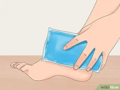 Image titled Get Rid of Bruises Step 1