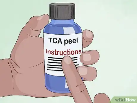 Image titled Apply a TCA Peel Step 3