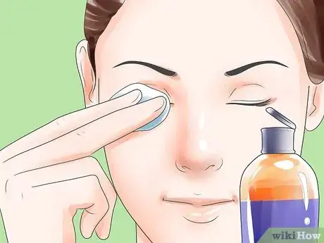 Image titled Cure Puffy Eyes Step 3