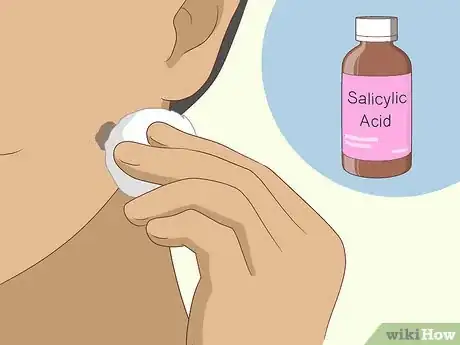 Image titled Get Rid of Moles on Your Face Step 8