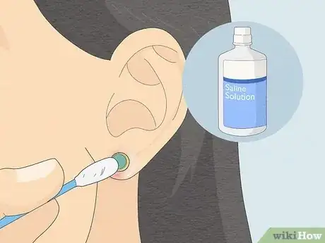 Image titled Clean Your Ear Piercing Step 6