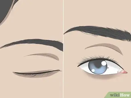 Image titled Get Sand Out of Your Eyes Step 2