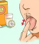 Get Rid of White Tongue