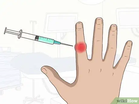 Image titled Relieve Gout Pain in Your Fingers Step 5