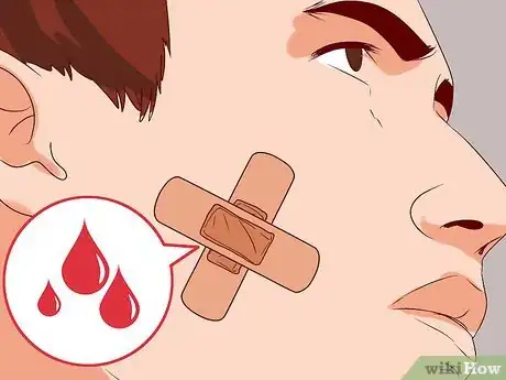 Image titled Get a Skin Tag Removed by a Doctor Step 7