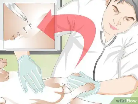 Image titled Get Fatty Tumors Removed in Dogs Step 10