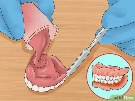 Image titled File Down Dentures Step 12