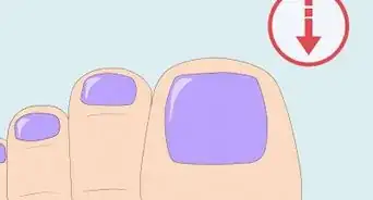 Fix a Split Toenail