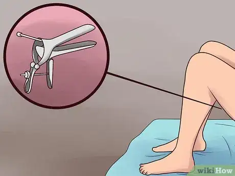 Image titled Prepare for a Pap Smear Exam Step 16