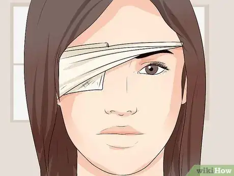 Image titled Remove a Speck From Your Eye Step 7