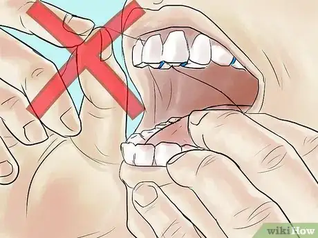 Image titled Eat With Separators in Your Mouth Step 12