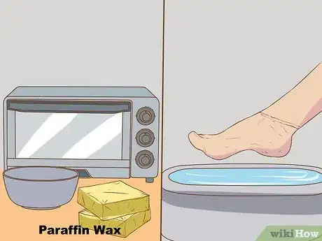 Image titled Remove Dead Skin from Feet Step 8