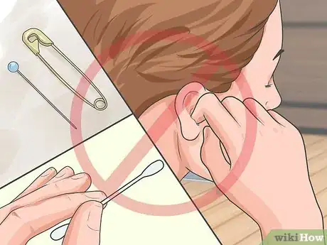 Image titled Remove Wet Wax from Infected Ears Step 4