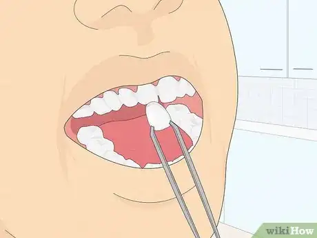 Image titled Fix Crooked Teeth Step 14