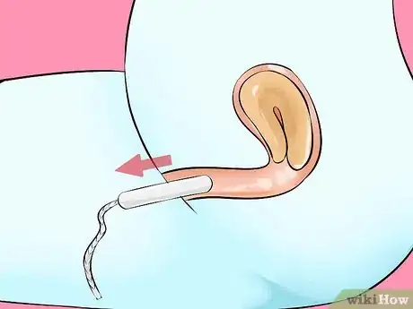 Image titled Remove a Tampon Step 1