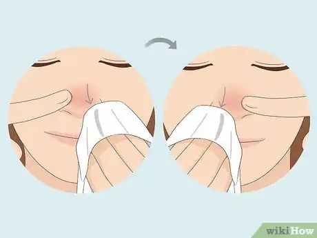 Image titled Get Rid of a Runny Nose Step 10