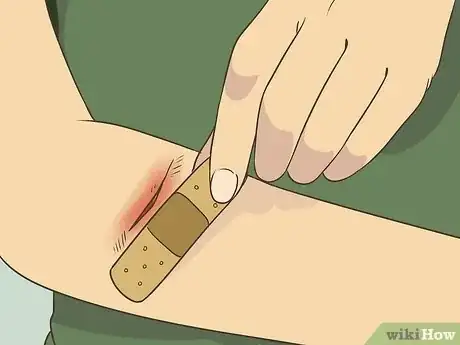 Image titled Use a Band Aid Step 1