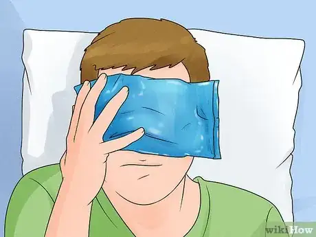 Image titled Get Pepper Spray Out of Eyes Step 9