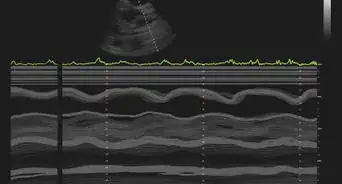 Interpret Echocardiograms