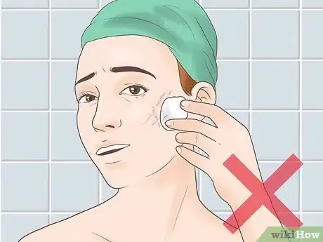 Image titled Use Salicylic Acid on Your Face Step 5