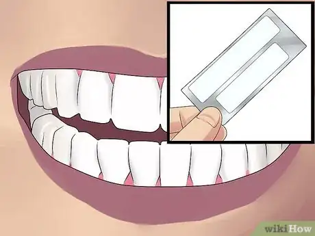 Image titled Whiten Teeth With Hydrogen Peroxide Step 3