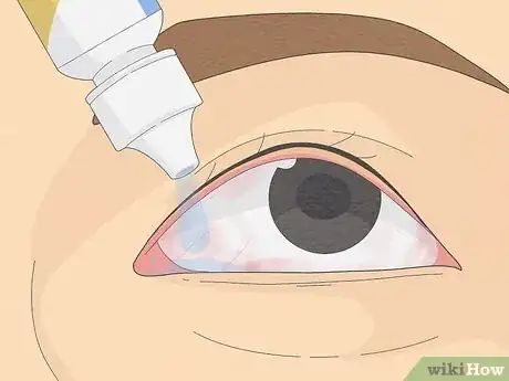 Image titled Get Sunscreen Out of Eyes Step 5