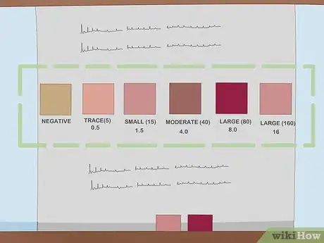 Image titled Read Ketosis Strips Step 6