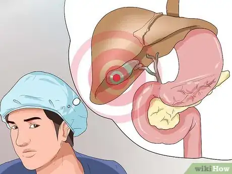 Image titled Identify Gallbladder Disease Step 9