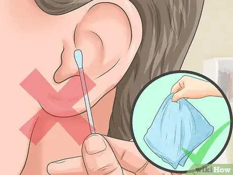Image titled Remove Wet Wax from Infected Ears Step 8