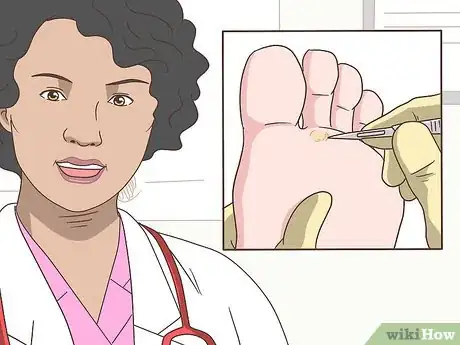 Image titled Treat Calluses on Your Hands and Feet Step 10