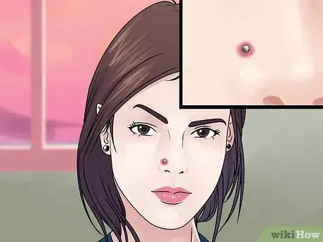Image titled Care for Your Nose Piercing Step 15