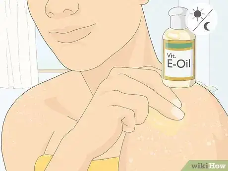 Image titled Get Rid of White Spots on the Skin Due to Sun Poisoning Step 1