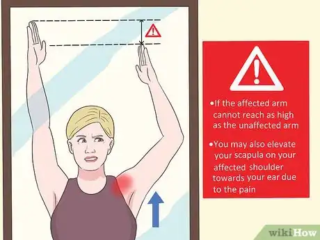 Image titled Diagnose Shoulder Pain Step 12