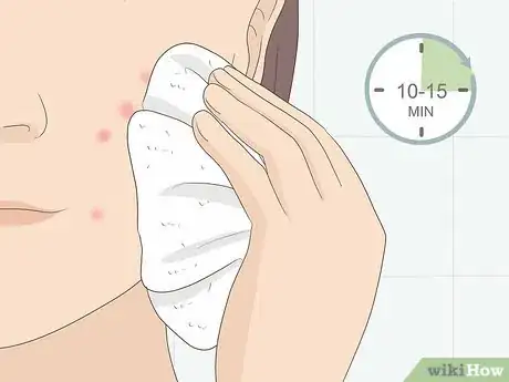 Image titled Treat Acne With Ice Step 2