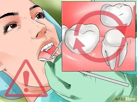 Image titled Avoid Dental Crown Problems Step 10