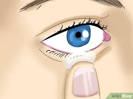 Image titled Take Out Contact Lenses Without Touching Your Eye Step 9