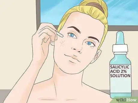 Image titled Use Salicylic Acid on Your Face Step 9