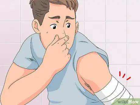 Image titled Determine if a Burn Is Infected Step 5