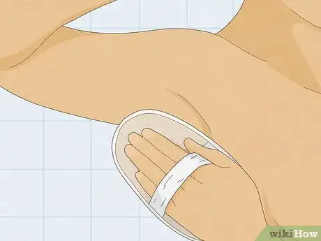 Image titled Remove an Ingrown Hair Under the Skin Step 5