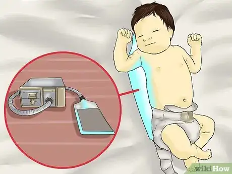 Image titled Lower Bilirubin Step 4