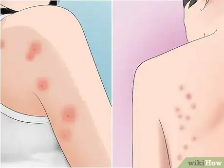 Image titled Avoid Insect Bites While Sleeping Step 1