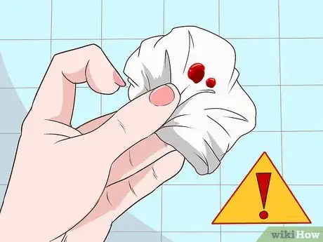 Image titled Stop Rectal Bleeding Step 1