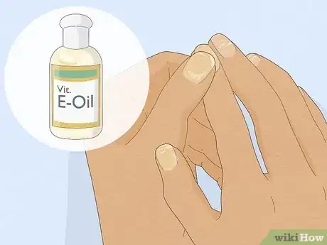 Image titled Get Rid of White Spots on Your Nails Step 1