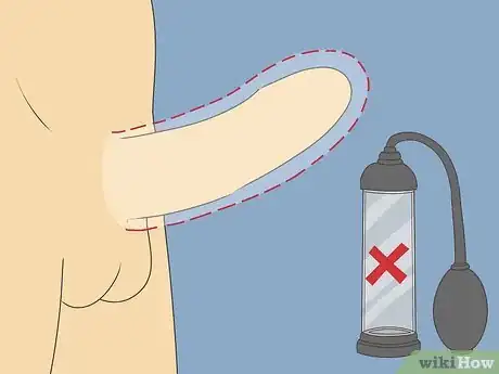 Image titled Use a Penis Pump Step 14