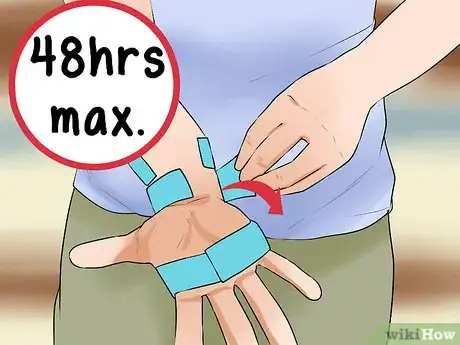 Image titled Wrap a Wrist for Carpal Tunnel Step 12