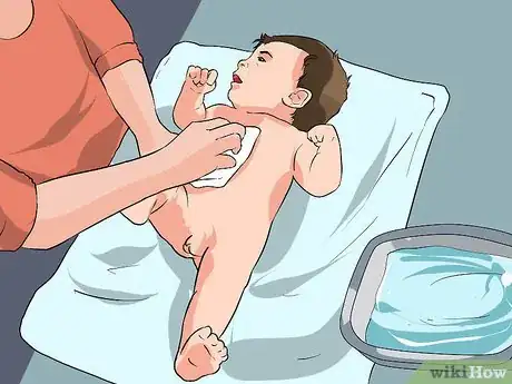 Image titled Prevent Cradle Cap Step 10